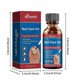 thumbnail image 3 of Nail Care Soluti, 3 of 5
