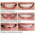 thumbnail image 2 of Smile On False Teeth Upper Lower Dental Veneers Dentures Tooth Cover Set, 2 of 5