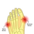 thumbnail image 2 of ZHAOCHENG ortesis para hallux valgus calcetín para férula hallux cojín protector funda protectora soporte para ortopedia hallux (pequeño), 2 of 4