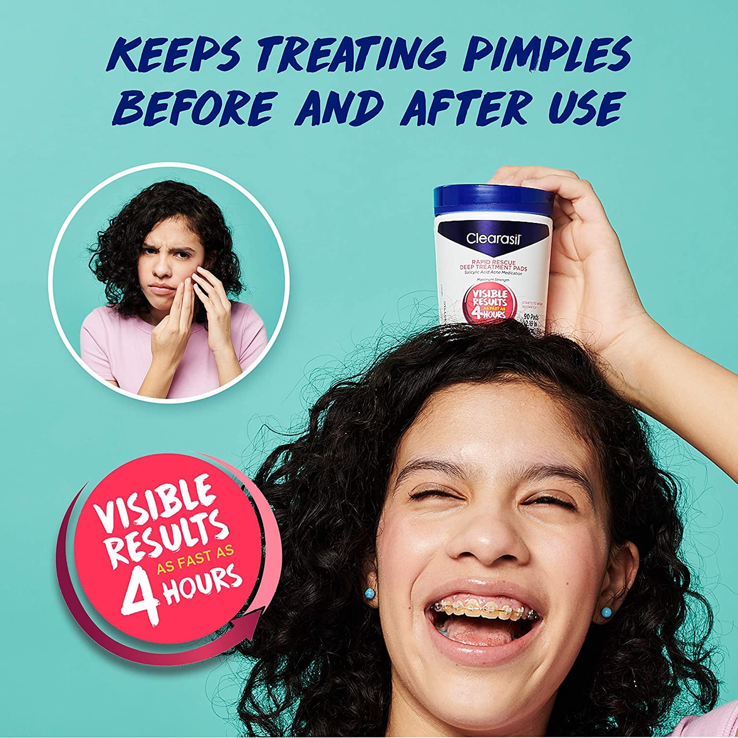 Acne Treatment Facial Cleansing Pads- Clearasil Rapid Rescue Deep Treatment Pads with Salicylic Acid Acne Medication, 90 Count Pack of 2