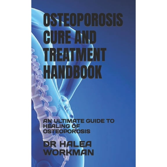 Osteoporosis Cure and Treatment Handbook : An Ultimate Guide to Healing of Osteoporosis (Paperback)