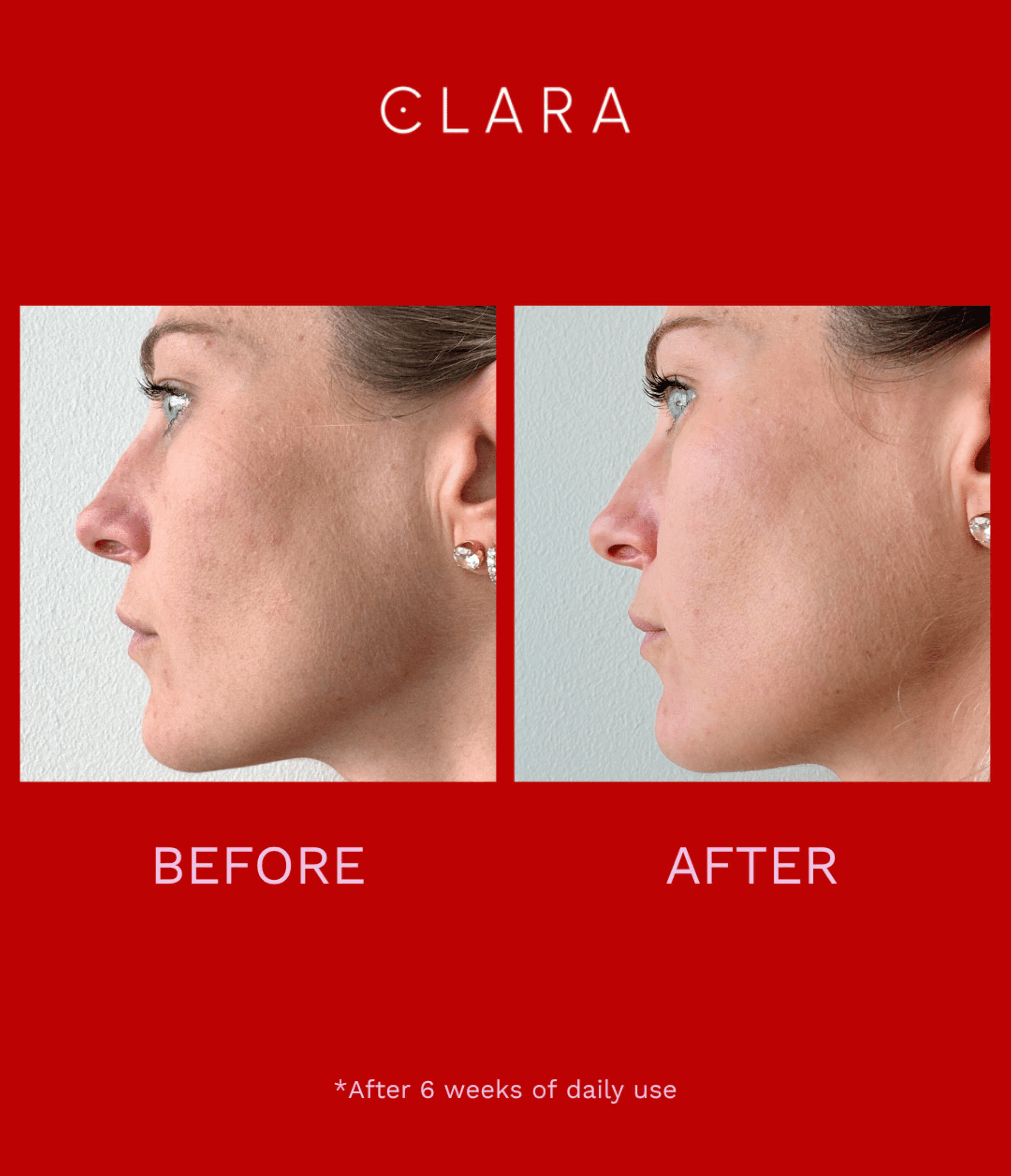 Clara Red Light Therapy LED Face Mask, Silicone, Adjustable, Collagen Boosting Anti-Aging for Radiant Skin