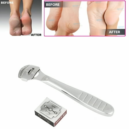 ACDANC Callus Remover Hard Dead Skin Corn Cutter Shaver Pedicure Foot Tool
