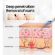 thumbnail image 3 of Lápiz láser para eliminar verrugas genitales Eliminación de verrugas en el ano Condilomas Herramientas de cuidado privado para hombres y mujeres, 3 of 6