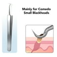 thumbnail image 3 of Pimple Popper Tool, Blackhead Tools Tweezers Anti Slip Excellent Gift  For Bedroom, 3 of 8