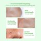 thumbnail image 5 of 2PCS LANBENA Face Serum Blackhead Remover Shrinking Pore Acne Treatment Deep Cleaning Smoothing Skin Care Firming Essence, 5 of 5