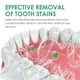 thumbnail image 5 of Limpiador de prótesis parciales y completas, spray blanqueador dental, de acción rápida similar a las pastillas limpiadoras de prótesis, spray para prótesis que elimina el mal aliento y refresca el al, 5 of 9