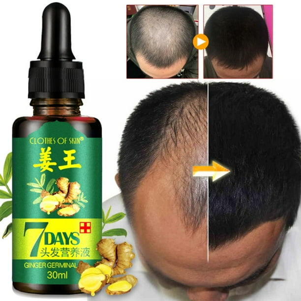 2PCS Hair Loss Regrow 7 Day Ginger Germinal Hair Growth ...