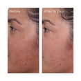 thumbnail image 3 of Rapid Dark Spot Correcting Serum Travel Size, 3 of 4