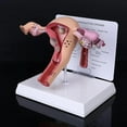 thumbnail image 3 of Pathological Uterus Ovary Model, Female Reproductive Organ Model Human Uterus Anatomical Model with Educational Display Card and Base, for Teaching Learning, 3 of 8