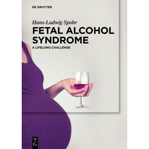 Fetal Alcohol Syndrome: A Lifelong Challenge, (Hardcover)