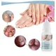 thumbnail image 4 of NewNail-suero para tratamiento de hongos, Gel líquido para reparación de pies, eliminación de hongos en las uñas de los pies, antiinfección, paroniquia, onicomicosis, Oil0903, 4 of 5