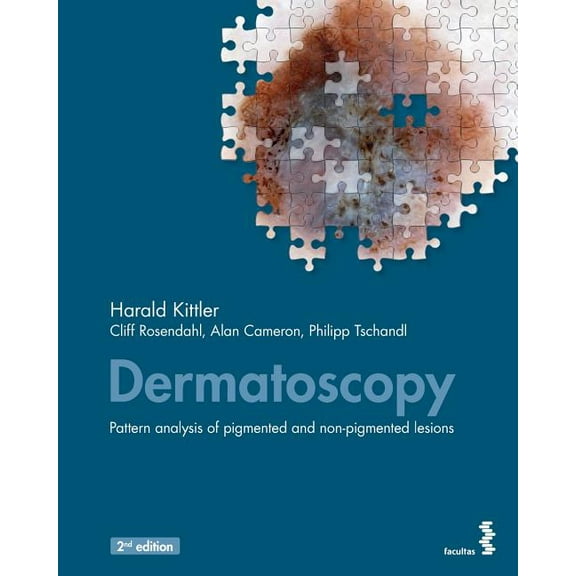 Dermatoscopy: Pattern analysis of pigmented and non-pigmented lesions (Paperback)