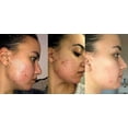 thumbnail image 3 of Gel de Retinol 0.1 Vitamin A Reparador de Líneas Finas y Arrugas, 3 of 6