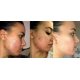 thumbnail image 3 of Gel de Retinol 0.1 Vitamin A Reparador de Líneas Finas y Arrugas, 3 of 6