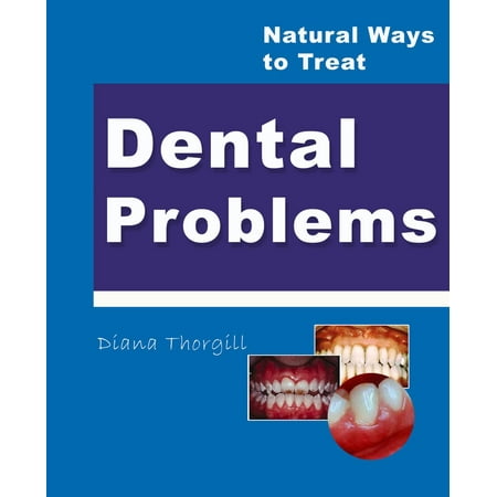 Natural Ways to Treat Dental Problems - eBook (Best Natural Way To Treat Erectile Dysfunction)