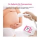 thumbnail image 2 of Doppler Fetal Ultrasonido Portátil Blanco con Rosa, 2 of 5