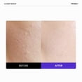 thumbnail image 3 of Sérum FRANKLY Closer Minimizador de Poros Antiedad 30 ml Vegan, 3 of 8