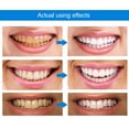 thumbnail image 3 of Kit de blanqueamiento dental con gel blanqueador (3 ml)., 3 of 8