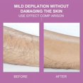 thumbnail image 2 of Crystal Hair Eraser  Painless Hair Remover Tool  Hair Removal with Epilator Crystal Hair Eraser Hair Remover for Leg Arm Back Body Beauty Depilation Tool, 2 of 2