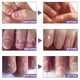 thumbnail image 4 of Esencia de reparación de uñas por hongos, tratamiento para el cuidado de los pies, dedo del pie, 30ml, 4 of 5