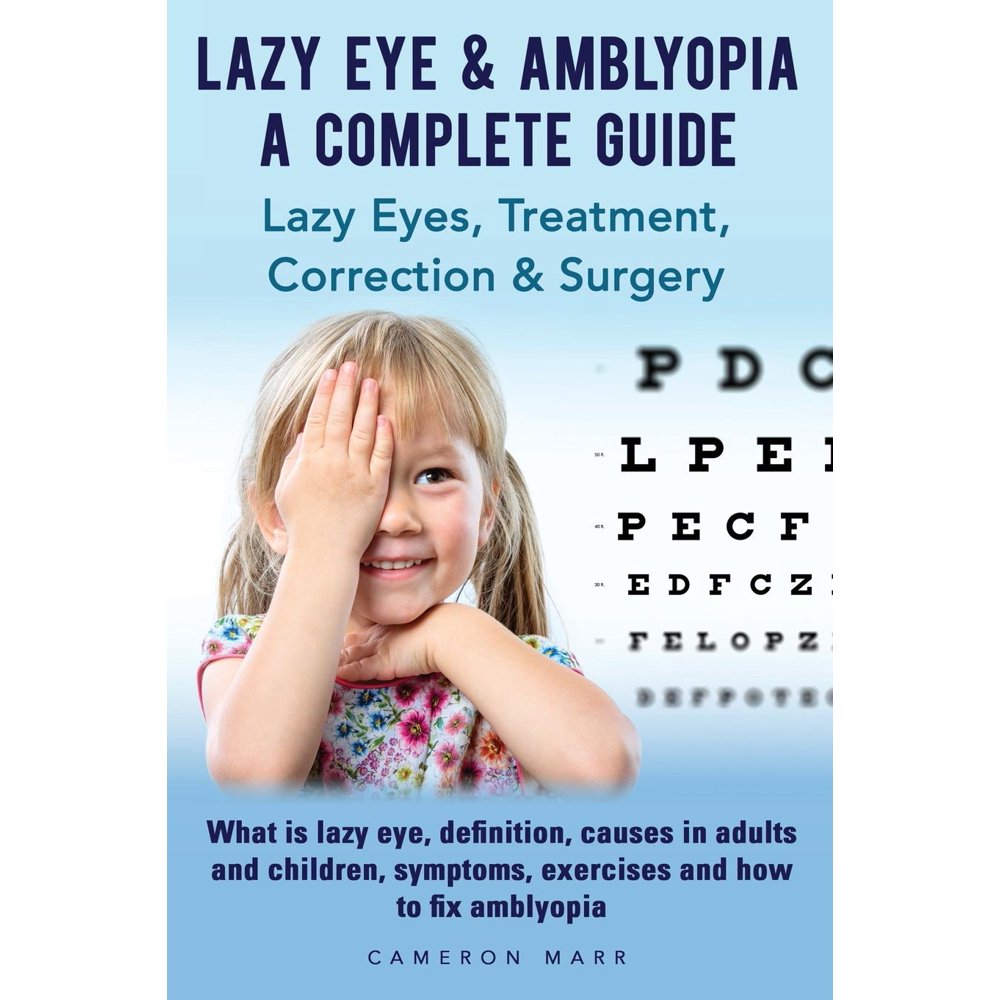 Lazy Eye & Amblyopia. Lazy eyes, treatment, correction and surgery