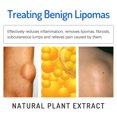thumbnail image 2 of 3PCS Fat Knot Cream Relieves Fat Clumps Subcutaneous Lumps Body Care Cream, Relieves Fatty Lumps Tumors Subcutaneous, 2 of 5