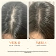 thumbnail image 4 of Sérum capilar Lilyeve Growturn con cepillo de 100 ml para el crecimiento del cabello, 4 of 9