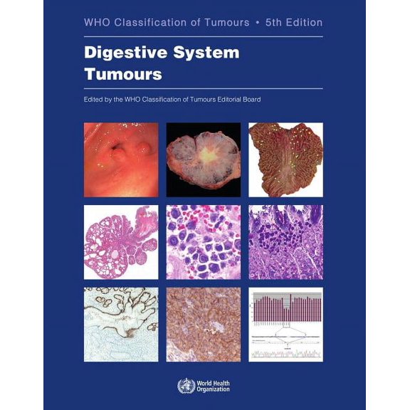 WHO Classification of Tumours Digestive System Tumours: Who Classification of Tumours, (Paperback)