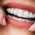 thumbnail image 6 of Orthodontic Dental Floss Picks for Effective Teeth Cleaning and Gum Health, 6 of 8