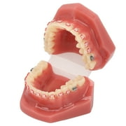 Ceramic dental orthodontic demonstration model tooth model with metal wire and bracket for teaching and learning