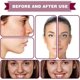 thumbnail image 2 of Tratamiento Facial Sérum Ácido de Frutas para Rosácea 30ml para Reducir Rojeces y Equilibrar Sebo 5p, 2 of 8