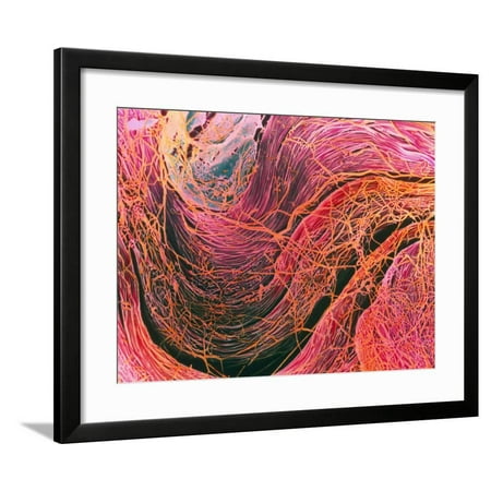 - Coloured SEM of Collagen Connective Tissue Fibres Framed Print Wall Art By Steve Gschmeissner