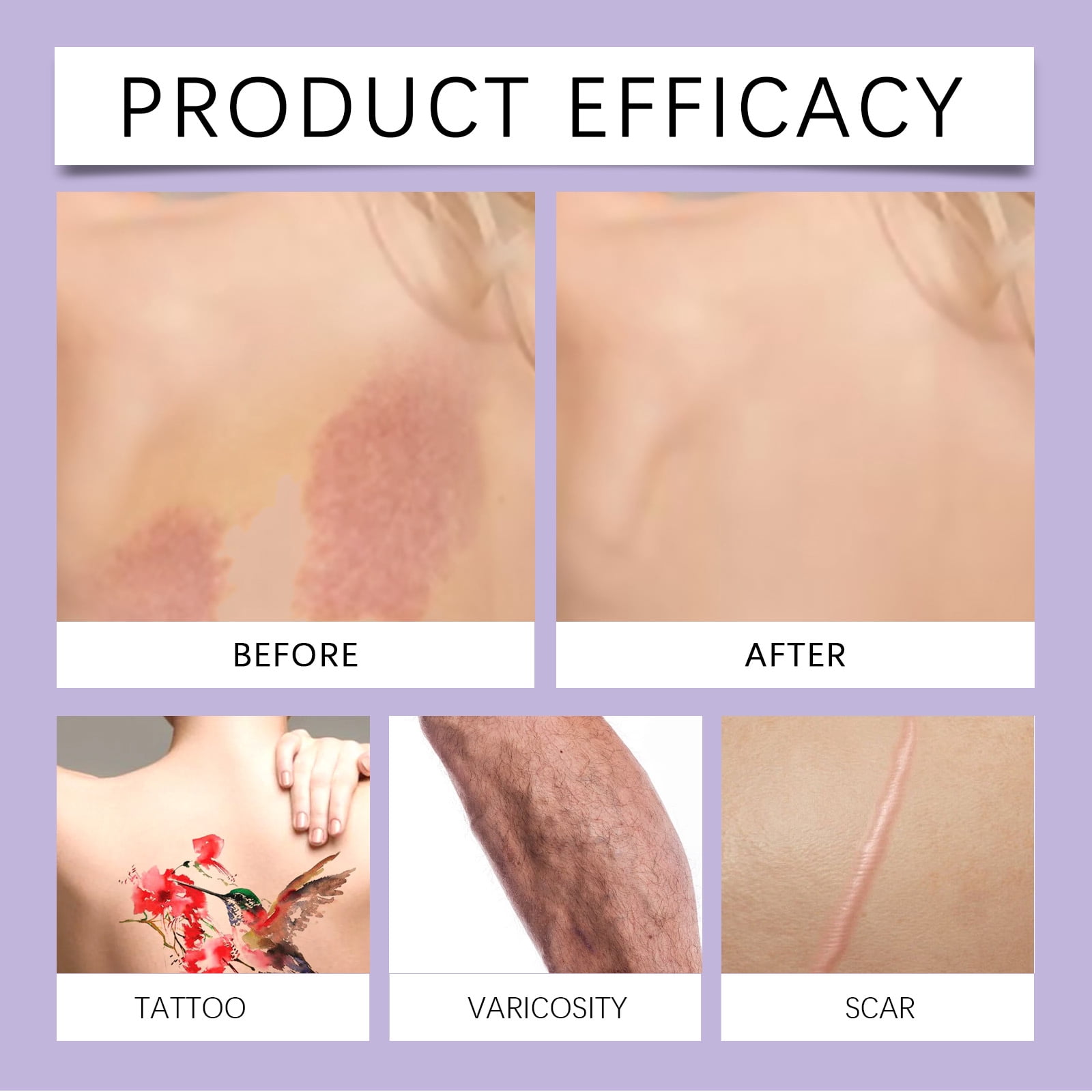 Alvantor Waterproof Tattoo Cover Up Makeup Concealer Body Coverage Perfector, Bronze 2.5 fl. oz