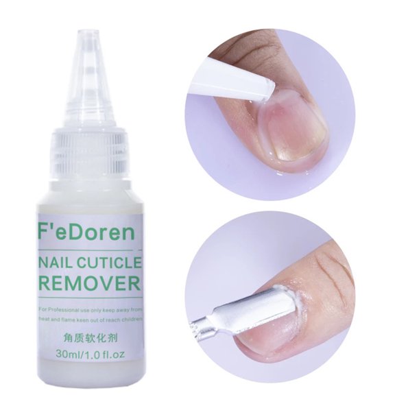 AURORA TRADE 30ml Nail Cuticle Remover Safe Ingredients Allergy Free Fast-acting Formula Eco-friendly Multipurpose Exfoliate Skin Care Cruelty-Free Formula Nail Liquid Exfoliator Nail Supplies