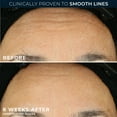 thumbnail image 5 of RoC Retinol Correxion Capsules, Anti-Aging Night Serum, Anti-Wrinkle Treatment, 30 Ct, 5 of 14