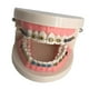 thumbnail image 3 of Modelo Avanzado de Ortodoncia con Soportes Metálicos Duraderos, 3 of 5