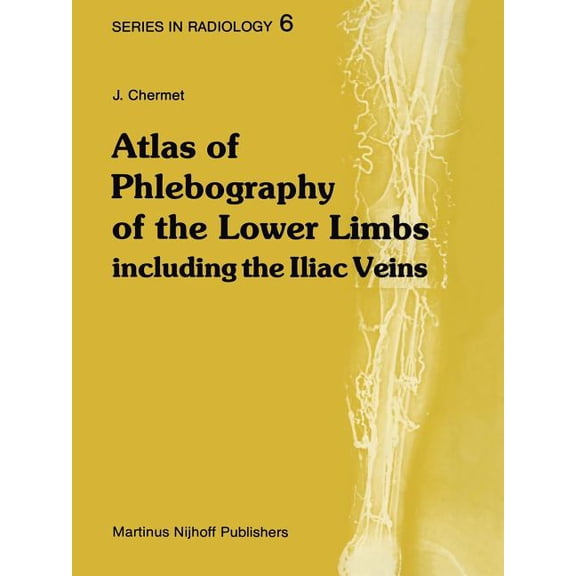 Radiology Atlas of Phlebography of the Lower Limbs: Including the Iliac Veins, Book 6, (Paperback)