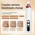 thumbnail image 4 of Aspirador de poros para eliminar puntos negros, limpiador facial visible, herramienta para el cuidado de la piel con aumento para granos de acné, extractor de puntos negros, para la extracción de, 4 of 6
