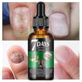 thumbnail image 1 of 7 Days Nail Fungus Treatment, 7 Days Nail Growth and Strengthening Serum Nail, Extra Strength Nail Repair Solution For Healthy Nail, 1 of 5