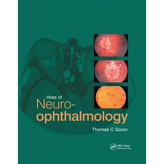 Atlas of Neuro-ophthalmology, (Paperback)