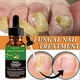 thumbnail image 4 of Multi-Purpose Ginger Infused Nail Repair Solution for Daily Use, 4 of 5