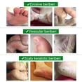 thumbnail image 4 of Tinea Pedis-Crema de tratamiento para curar el olor de los pies, inhibe la ulceración de hongos, ungüento de hierbas antipicazón, 1-3-5 Uds., 4 of 4