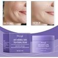 thumbnail image 4 of Openpig Liquidation Beurre Raffermissant pour Jeunes Hydratant Beurre Raffermissant pour Jeunes Beurre Raffermissant pour le Corps Crème Hydrate et Améliore les Ridules 50g, 4 of 9