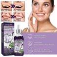 thumbnail image 4 of Enjuague bucal concentrado Jaysuing para mal aliento, manchas en los dientes, limpieza de dientes amarillos, boca fresca, enjuague bucal blanqueador de dientes BF |, 4 of 5