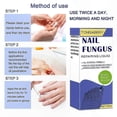 thumbnail image 5 of Powerful Nail Fungus Solution - 30ml Toenail Repair Treatment for Stronger, Healthier Nails, 5 of 5