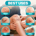 thumbnail image 4 of Dimora Hydrocolloid Wound Dressing, 4" x 4" Ultra Thin Large Patch Bandages,  Sterile Self-Adhesive Patches for Bed Sores, Burns, and Blisters, Fast Healing, 10 Count, 4 of 9