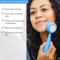 thumbnail image 2 of Cepillo de limpieza facial PMD Beauty Smart Silicone con luz azul, 2 of 9