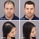 thumbnail image 2 of Fibras Formadoras de Cabello Toppik Light Blonde 12 g, 2 of 11