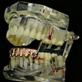 thumbnail image 6 of 14k Rose Gold Plated Nugget Grillz Bottom Slugs Lower Teeth 6 Piece Grill Hip Hop Mouth Grills, 6 of 6